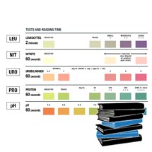 Urinalysis Test Strip Color Chart